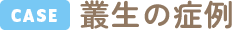 叢生の症例